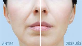 CREMA FACIAL CON ACIDO HIALURONICO (50ml